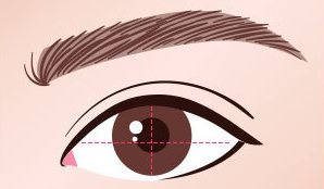 수술방법 03 — 눈 가로 형태 밸런스 조정(가로·세로 점선 표시 눈 그림)